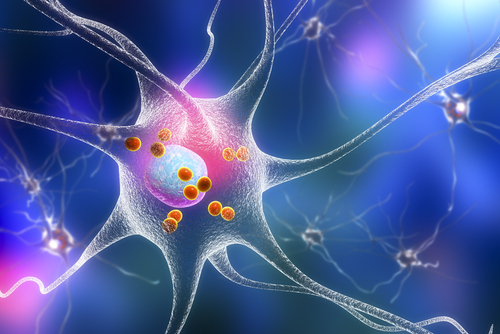 Parkinsons