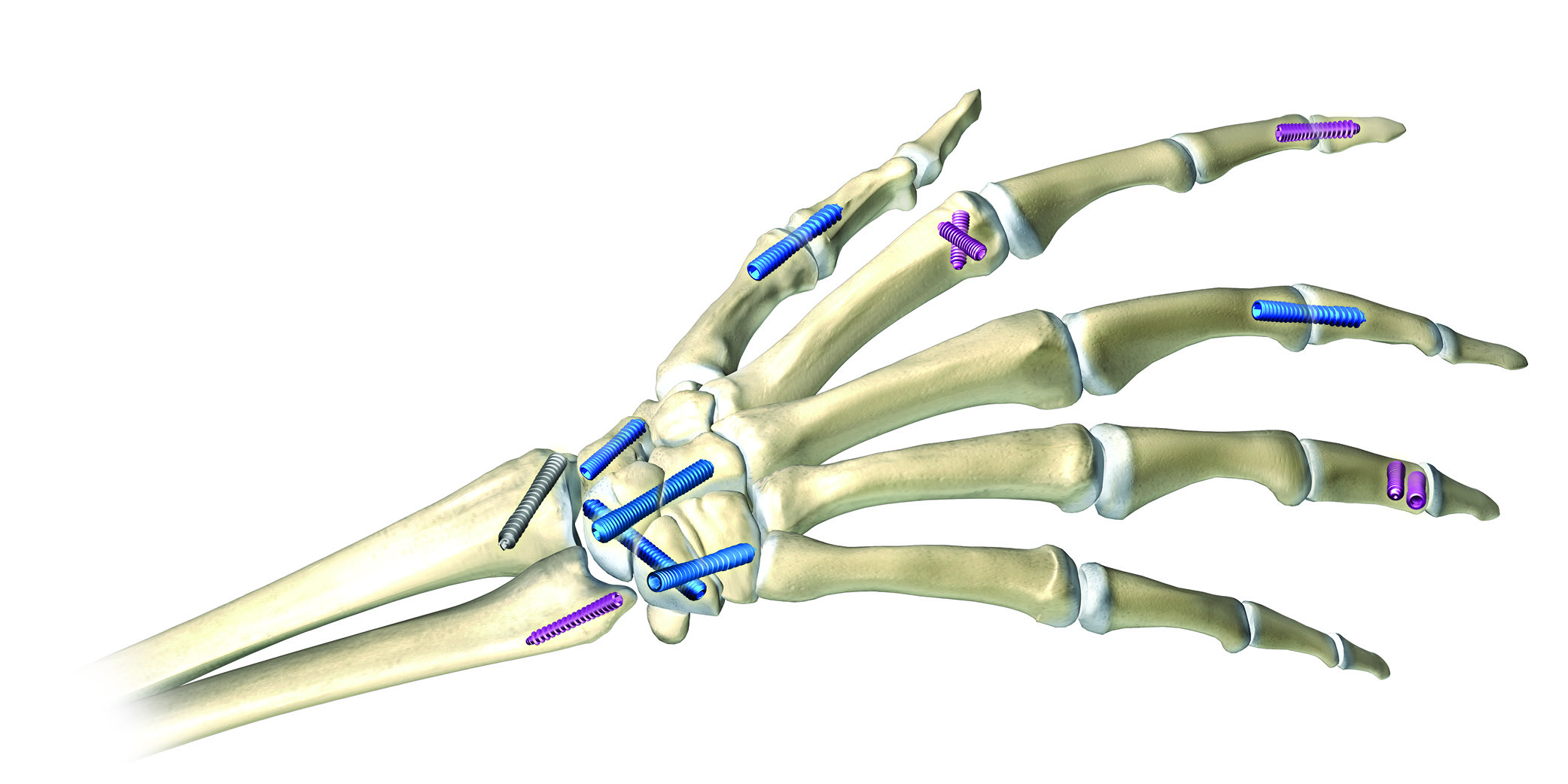 Medical + Optical